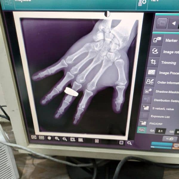 portable x-rays machine GE 03375100123 4