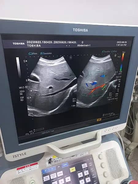 ultrasound machine | Toshiba | japanese | ultrasound machines 9