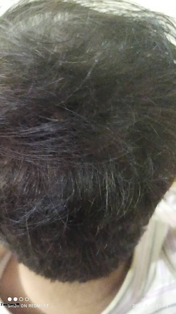 Ramzan Offer  Toppik hair fiber 2 pack offer only 1999.  Caboki ha 5
