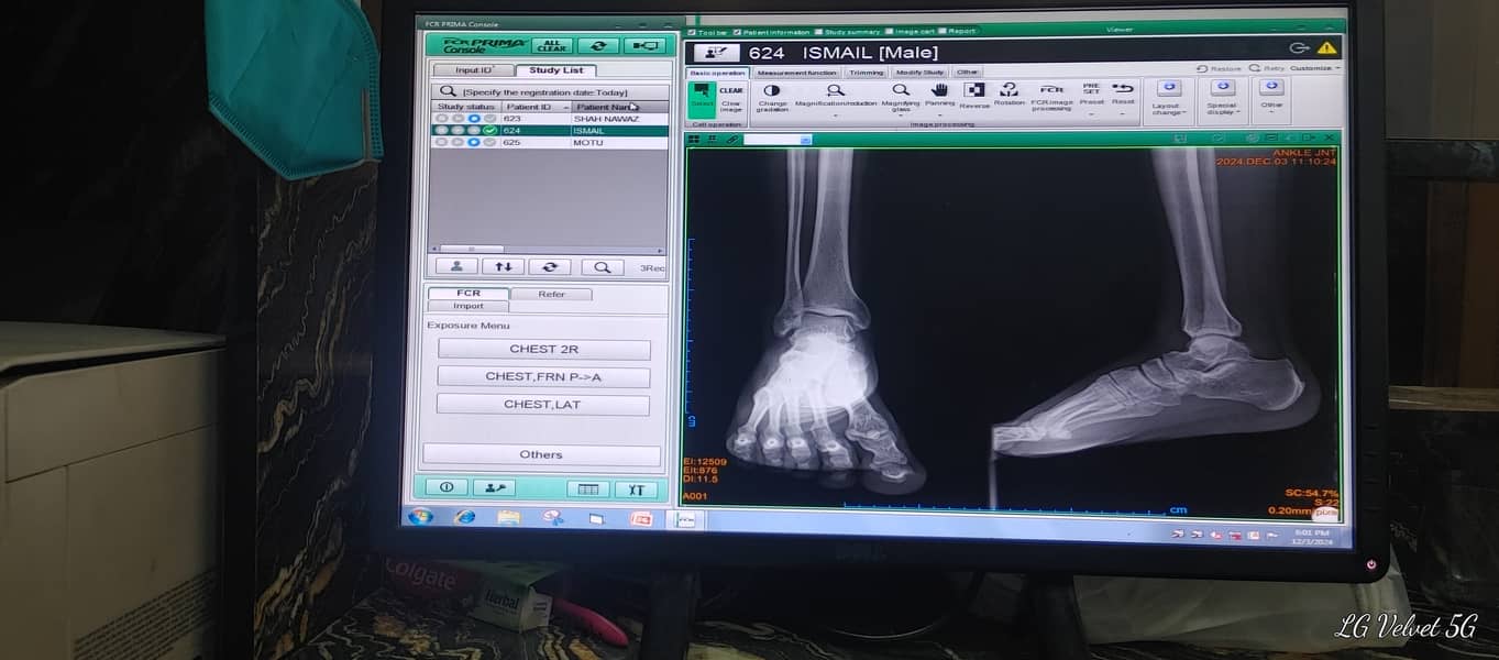 Digital X-Ray Inkjek  Complete set up for sell Sanghar 7