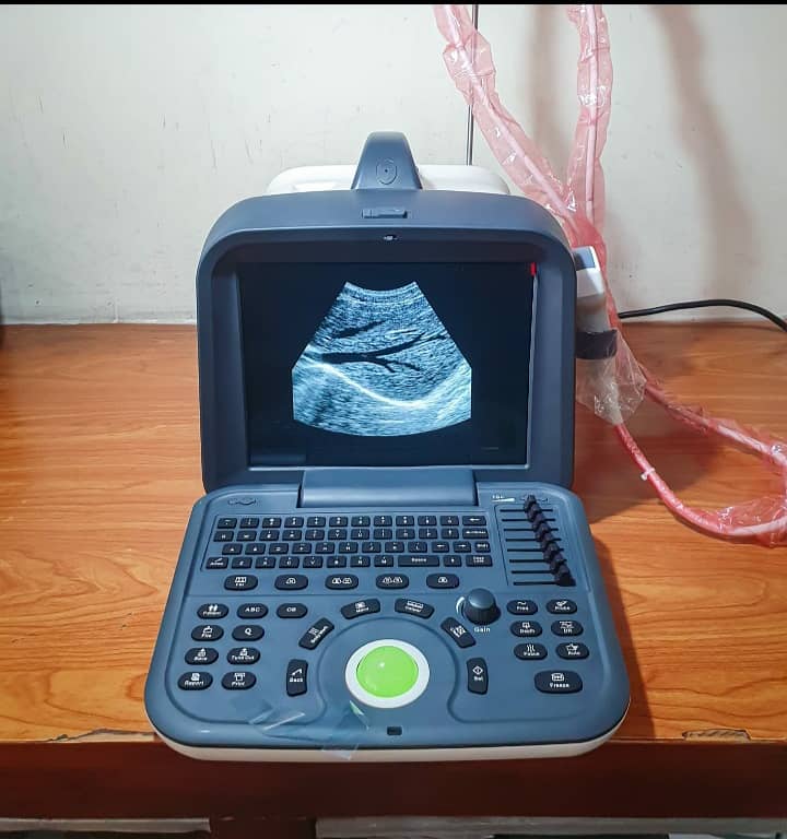 used portable ultrasound machine,ultrasound machines 0