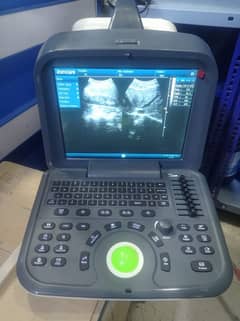 Ultrasound