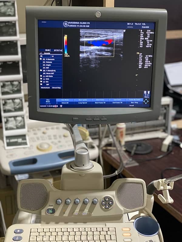 g e logic p5 ultrasound 1