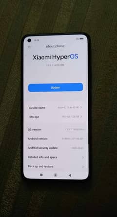 xiomi mi 11 lite 5g         03065512404