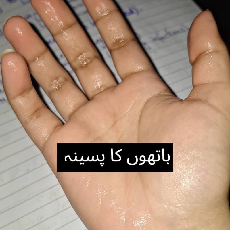 Iontophoresis for sweaty hands & feet, dermadry, iontoderma. Sweating. 1