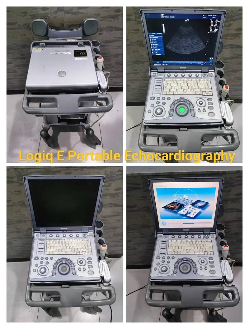 Ultrasounds Machines/ Echocradiography Machines 2