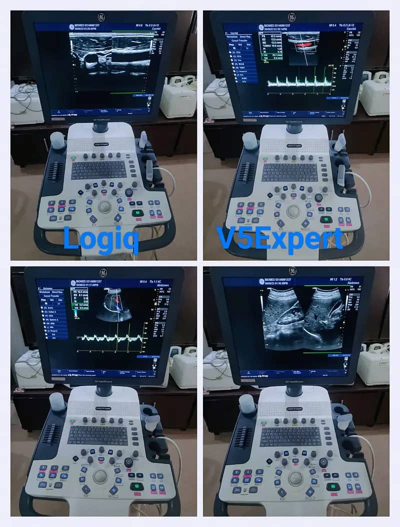 Ultrasounds Machines/ Echocradiography Machines 5