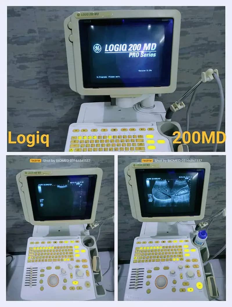 Ultrasounds Machines/ Echocradiography Machines 7