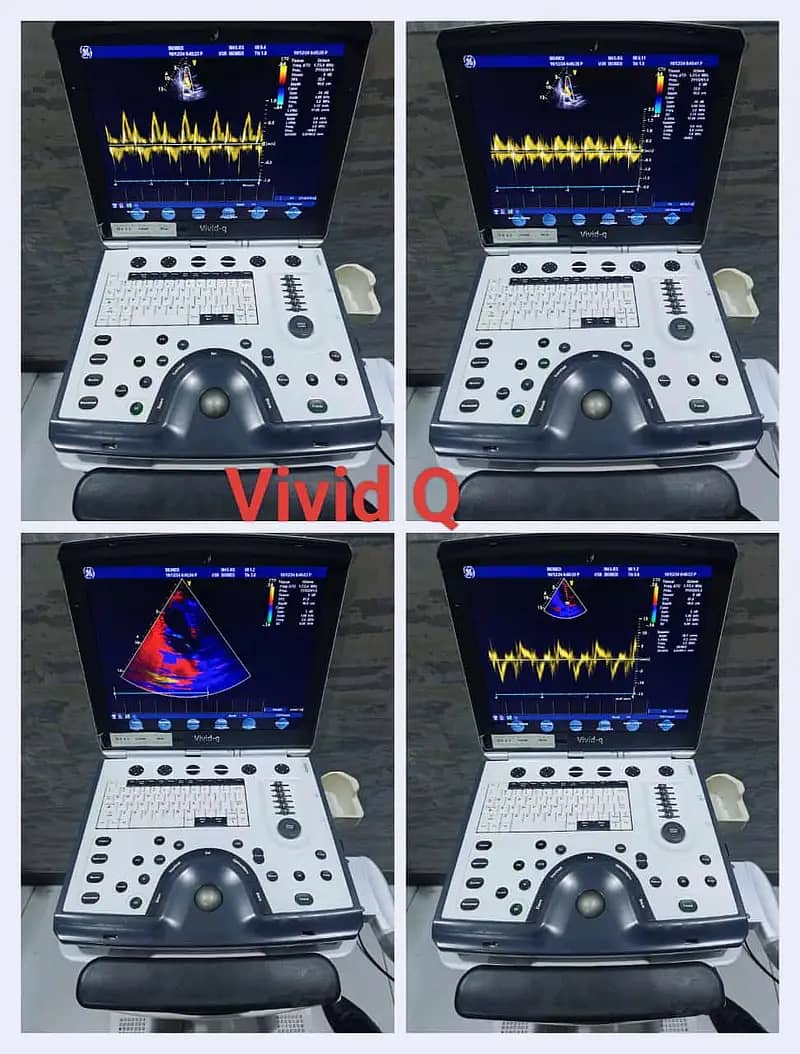 Ultrasounds Machines/ Echocradiography Machines 9
