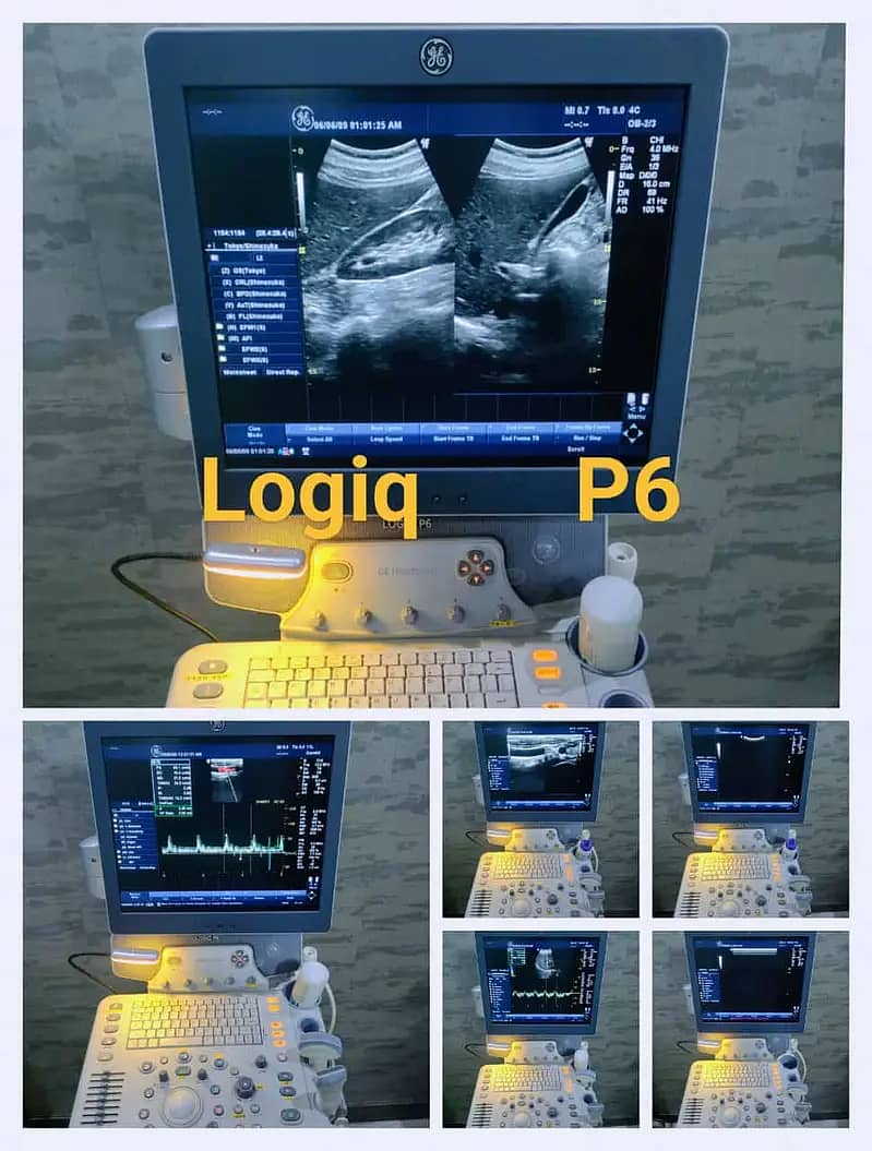 Ultrasounds Machines/ Echocradiography Machines 16