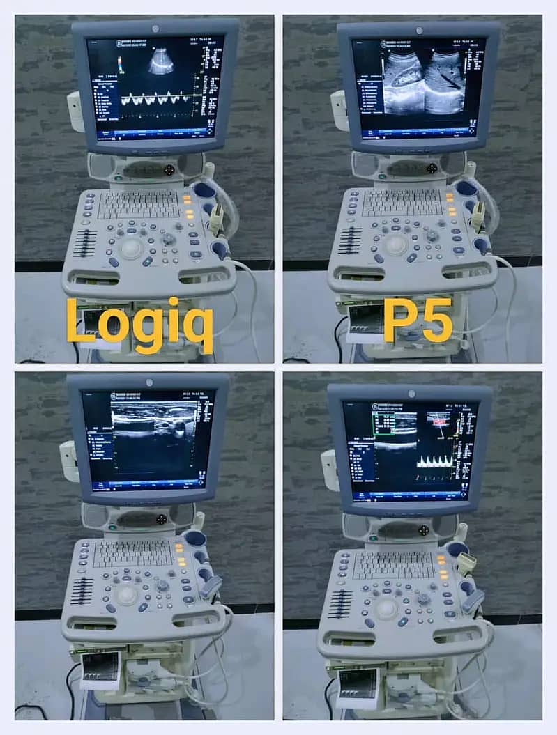 Ultrasounds Machines/ Echocradiography Machines 17