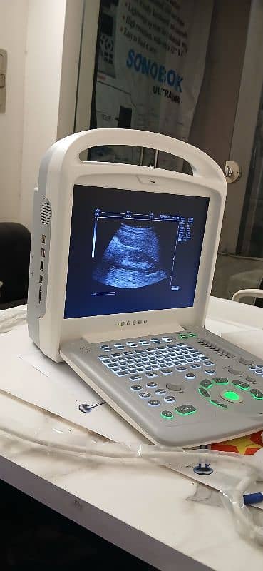 OCTA 880 BIG LCD BIG IMAGE SIZE DIGITAL ULTRASOUND MACHINE 0