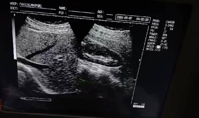 OCTA 880 BIG LCD BIG IMAGE SIZE DIGITAL ULTRASOUND MACHINE 4