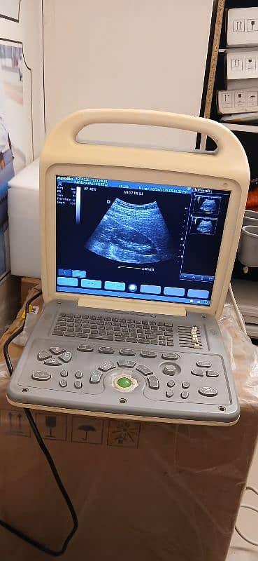 OCTA 880 BIG LCD BIG IMAGE SIZE DIGITAL ULTRASOUND MACHINE 9