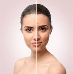 Skin care Oil
