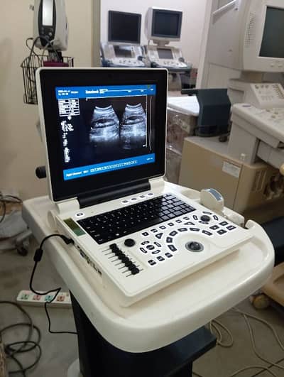 Ultrasound Machines / Used Ultrasound Machine / New Ultrasound Machine