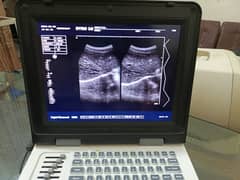 All Models of ultrasound machine and ecg machine available