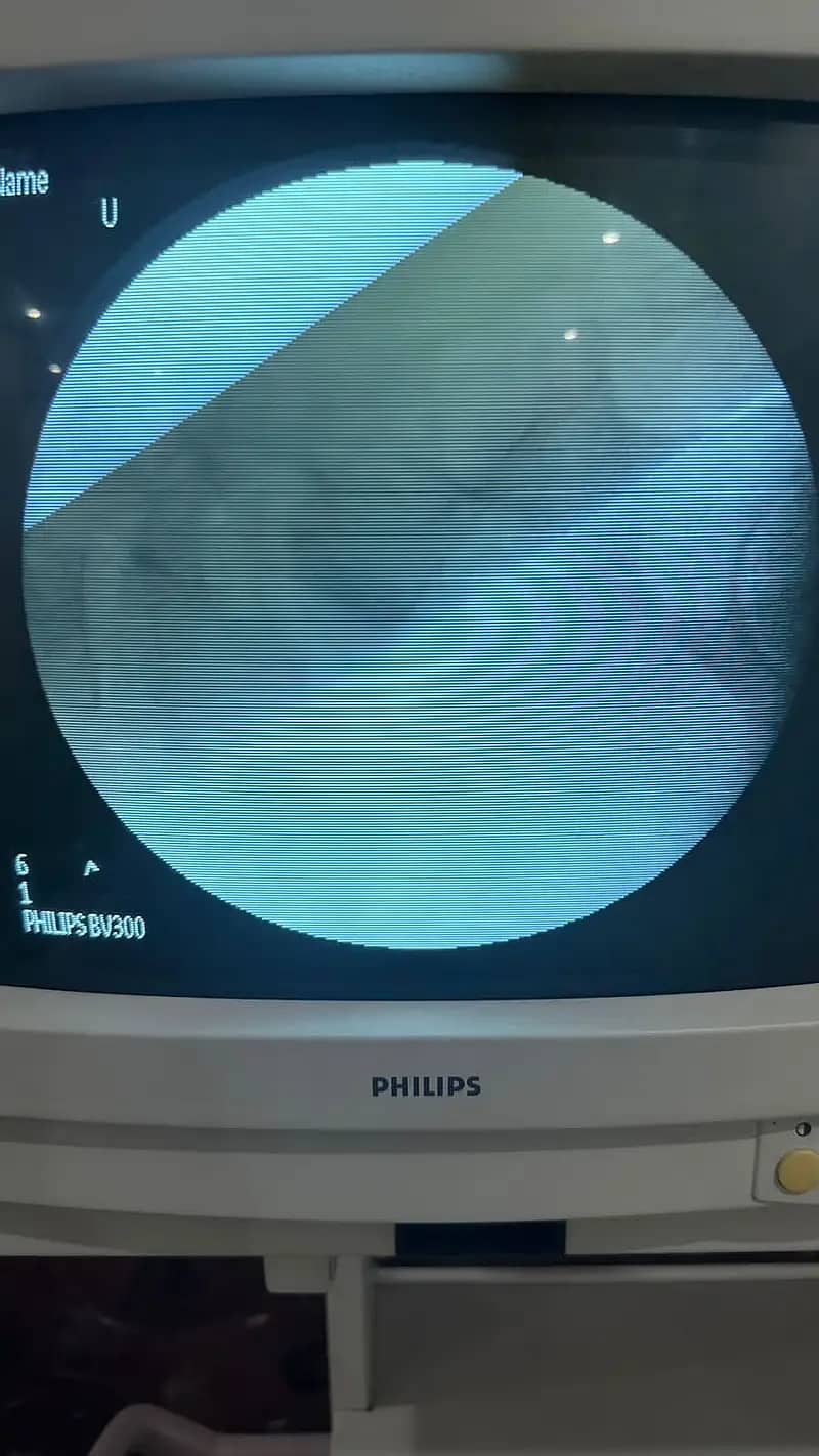 Digital Xray Machine C Arm CR system Carm Imaging fluoroscopy OT C-Arm 6