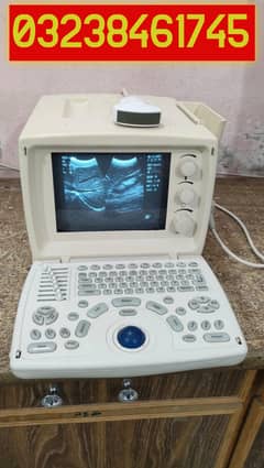 ultrasound