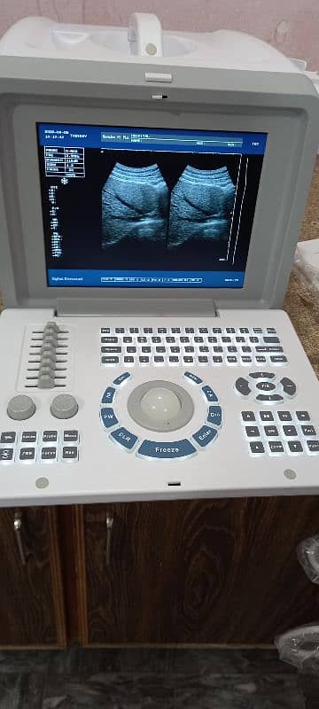 Ultrasound machine New Stock Available Whtsap-03126807471 I 0