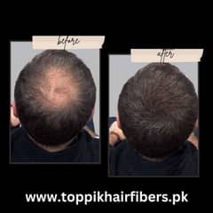 Toppik