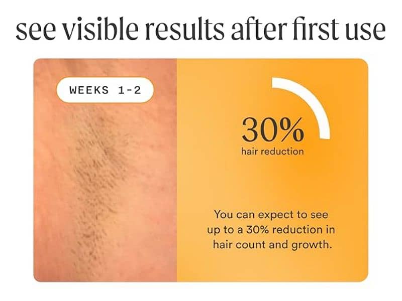Nood Flash 2.0 IPL Laser Hair Removal Device for Men and Women 7