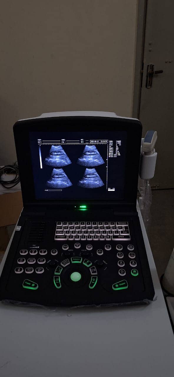 China New Ultrasound Machine/Sono Point S-15/High Resolution/Battery 0
