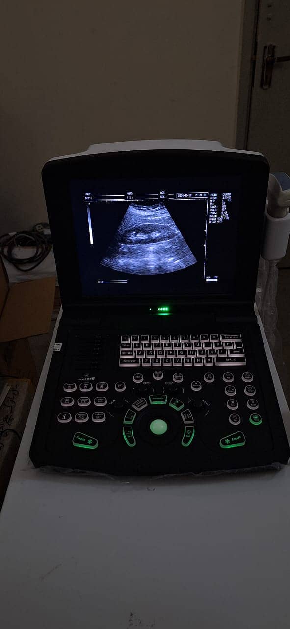 China New Ultrasound Machine/Sono Point S-15/High Resolution/Battery 5