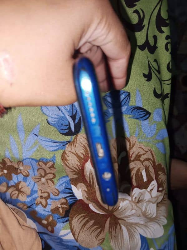 condition 9/10 0