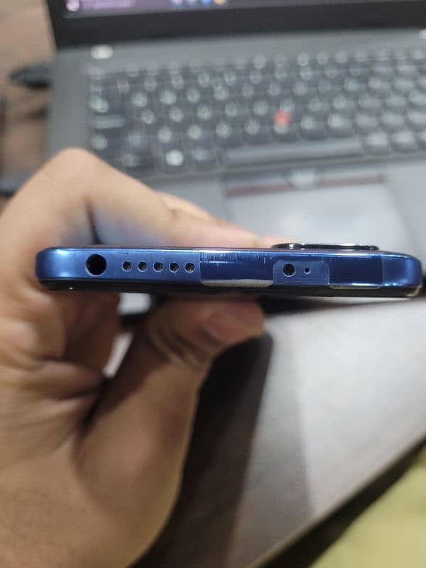 redmi note 11 6 128 3