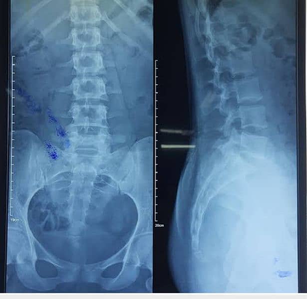 Need X Ray Technician 0