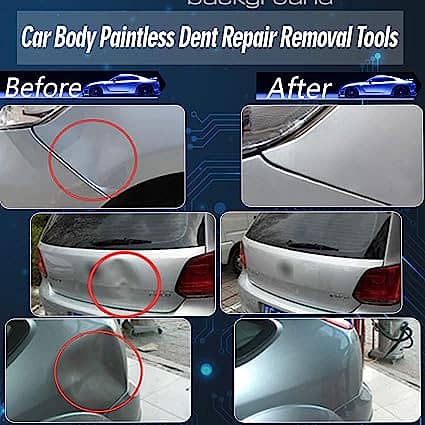 Paintless Dent Repair Kits 1