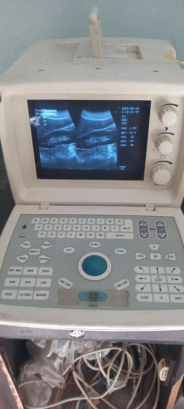 Ultrasound machine New Stock Available Whtsap-03126807471 1