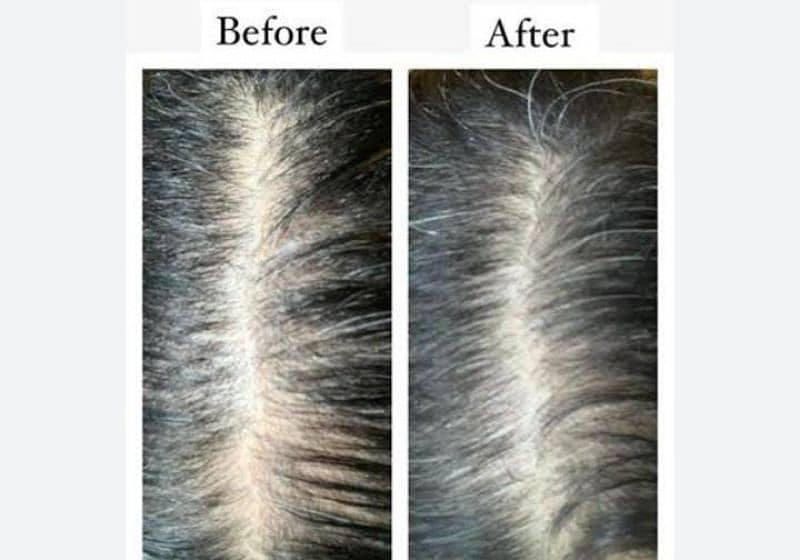 organic hair growth oil 1