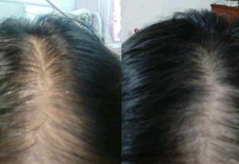 organic hair growth oil 2