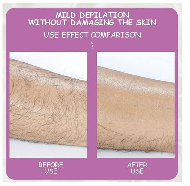 Hair Remover Epilator 1