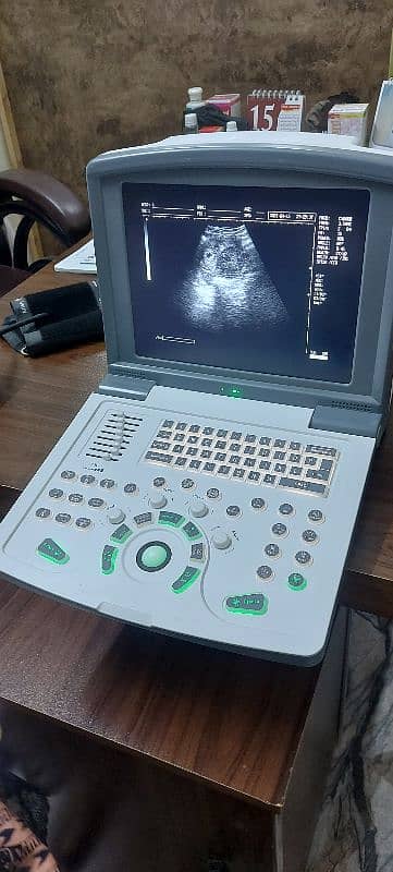 Novadex N9 Ultrasound Scanner, Ultrasound Machine 3