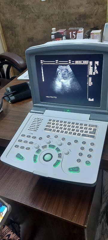 Novadex N9 Ultrasound Scanner, Ultrasound Machine 4