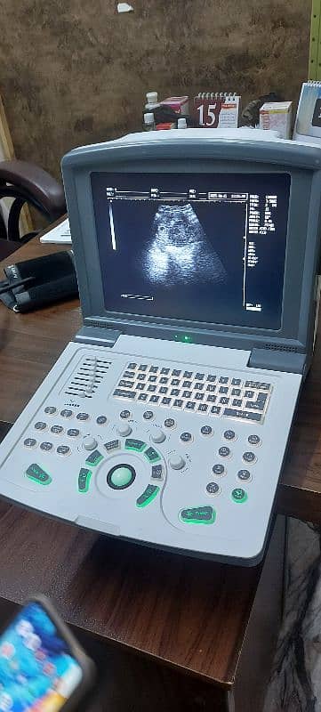 Novadex N9 Ultrasound Scanner, Ultrasound Machine 5