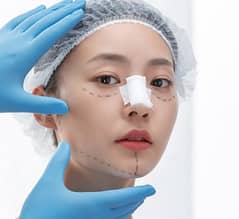 Rhinoplasty in Riyadh