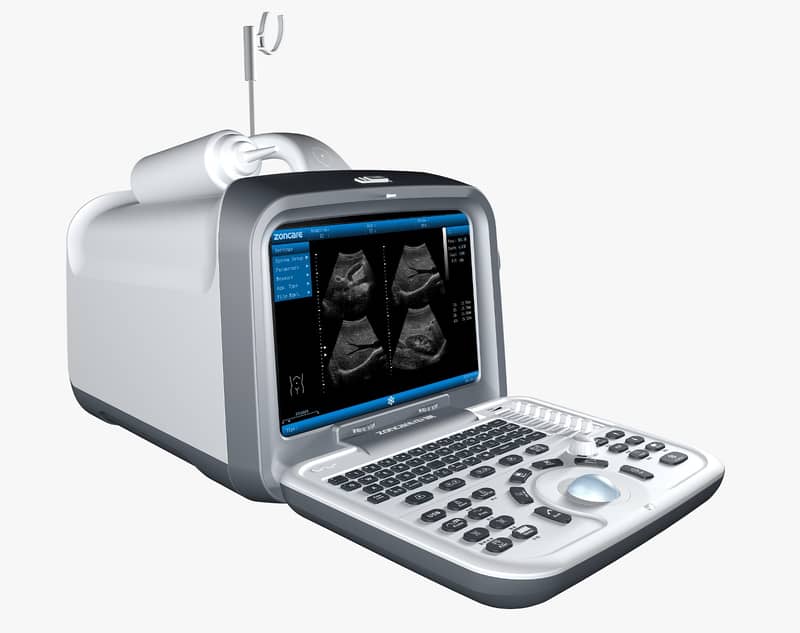 Brand new ultrasound machines | Portable ultrasound |Color ultrasound 1