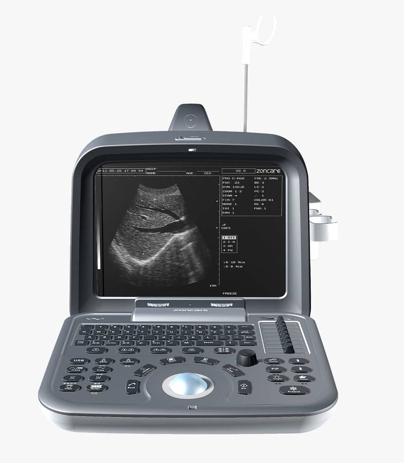 Brand new ultrasound machines | Portable ultrasound |Color ultrasound 5