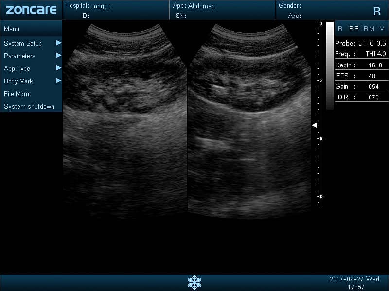 Brand new ultrasound machines | Portable ultrasound |Color ultrasound 7