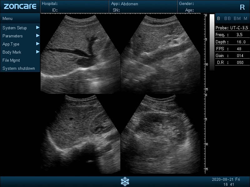 Brand new ultrasound machines | Portable ultrasound |Color ultrasound 8