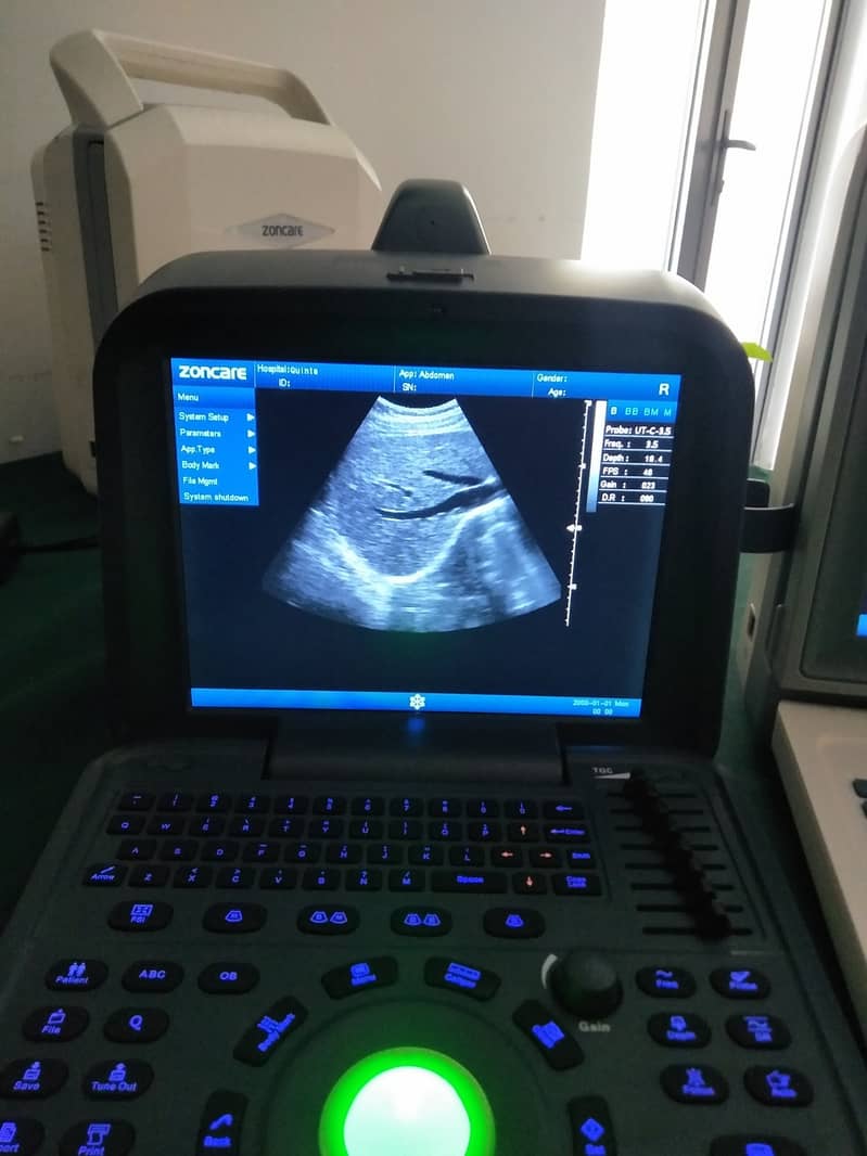 Brand new ultrasound machines | Portable ultrasound |Color ultrasound 9