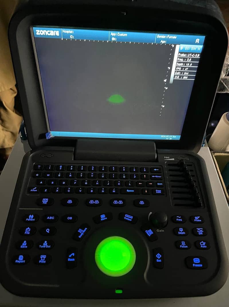 Brand new ultrasound machines | Portable ultrasound |Color ultrasound 12
