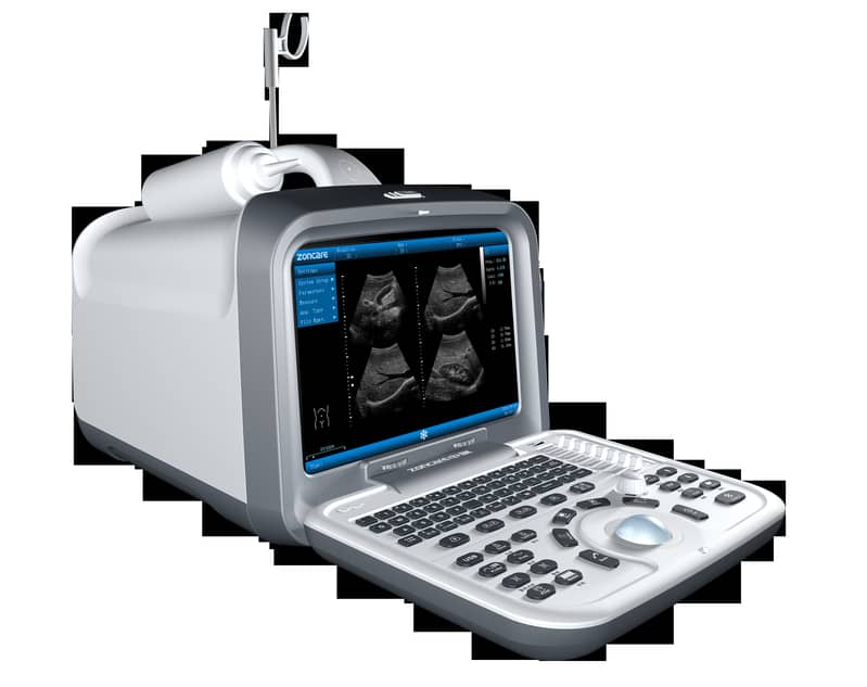 Brand new ultrasound machines | Portable ultrasound |Color ultrasound 15