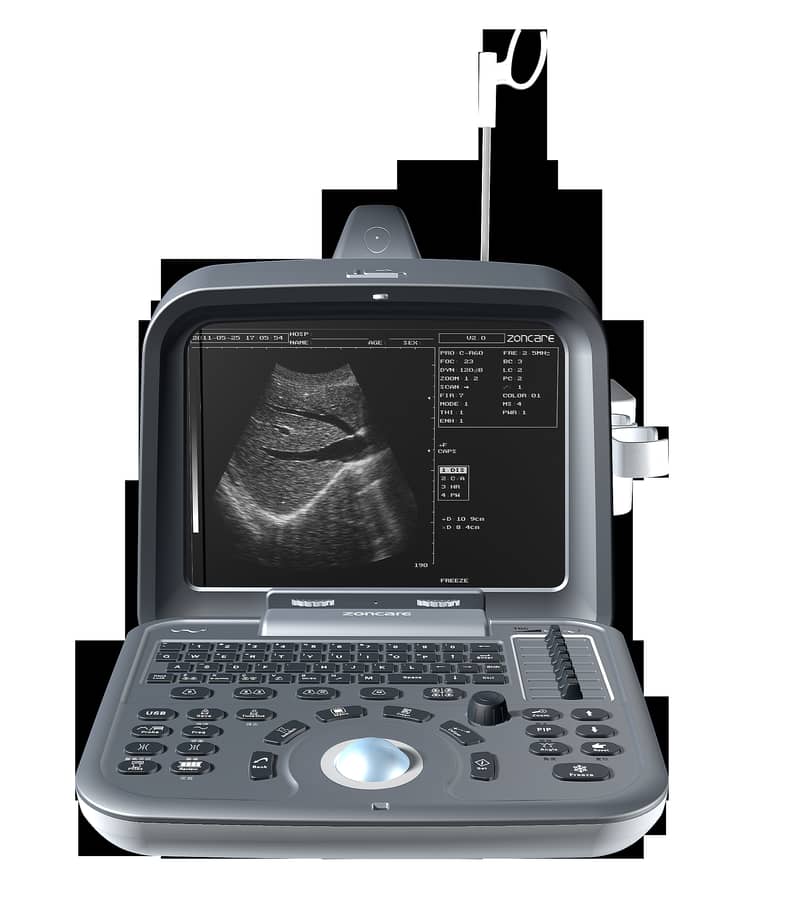 Brand new ultrasound machines | Portable ultrasound |Color ultrasound 17