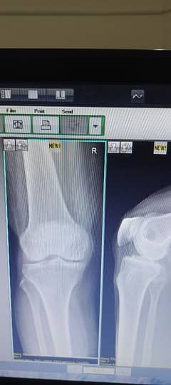 X Ray