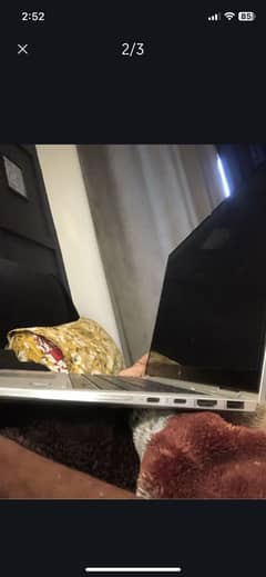Hp